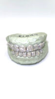 Diamond Honeycomb Set Grillz