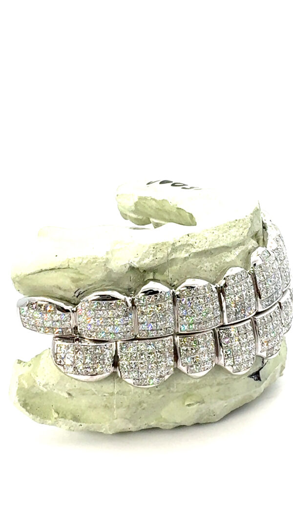 VVS Invisible Set Grillz