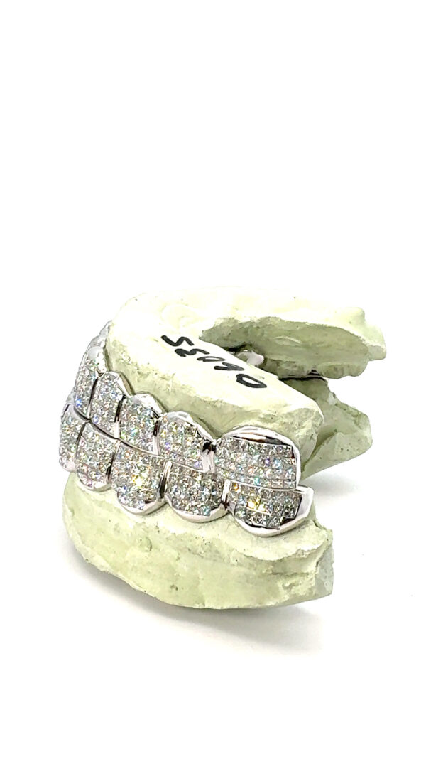 VVS Invisible Set Grillz
